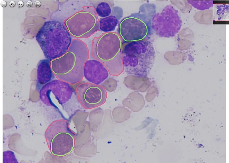 cytoplasm segmentation