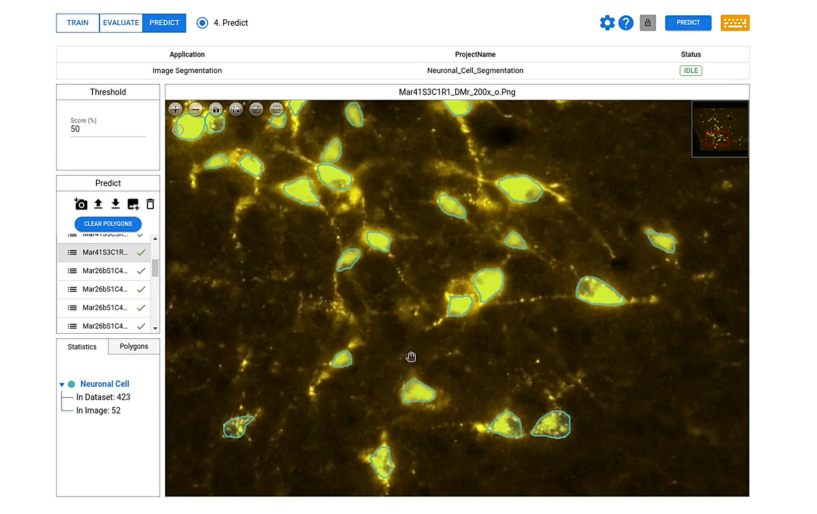 neuron segmentation
